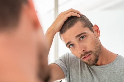 Hair Systems Melbourne Hair Replacement Systems For Men